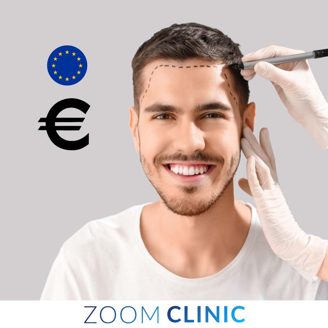 تكلفة زراعة الشعر في تركيا باليورو