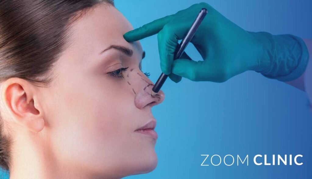 Rhinoplasty in Istanbul 