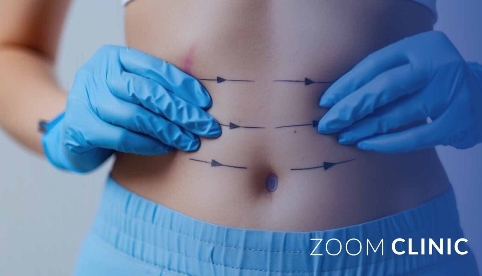 Transform Your Postpartum Body: Effective Strategies to Combat Sagging ...