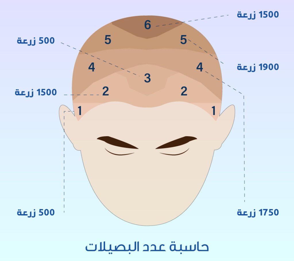 حاسبة بصيلات الشعر