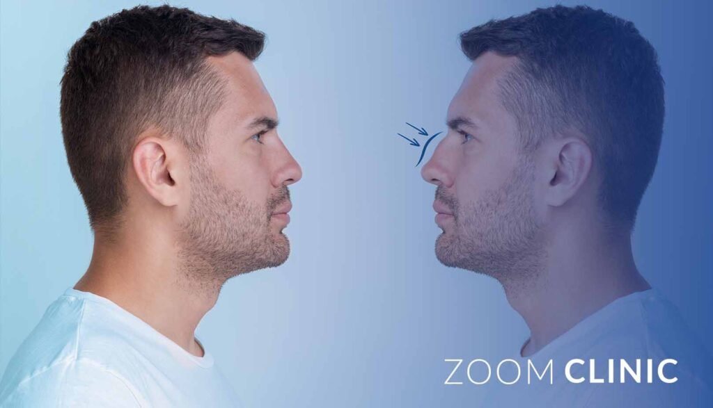 Rhinoplasty for men