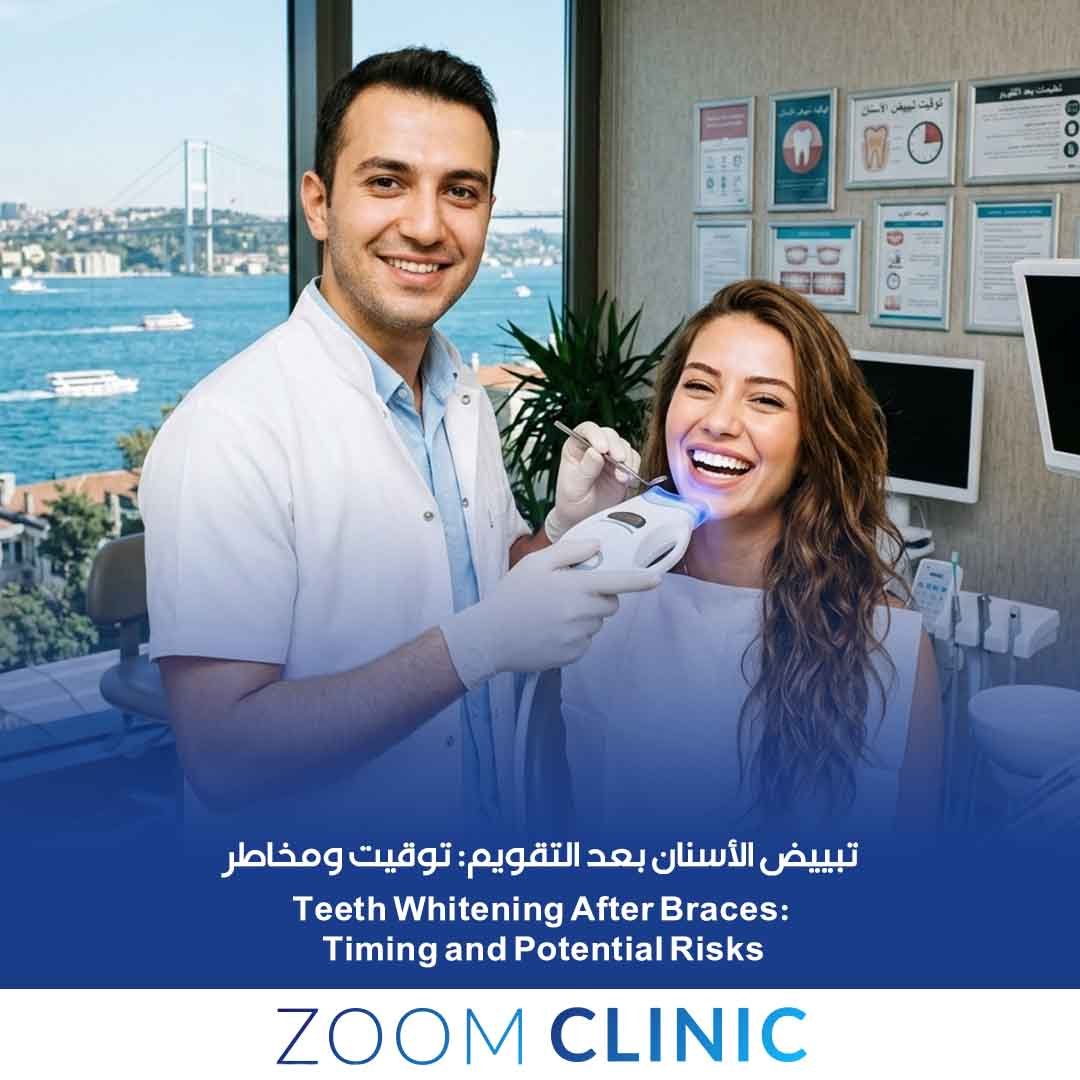 Teeth whitening after braces