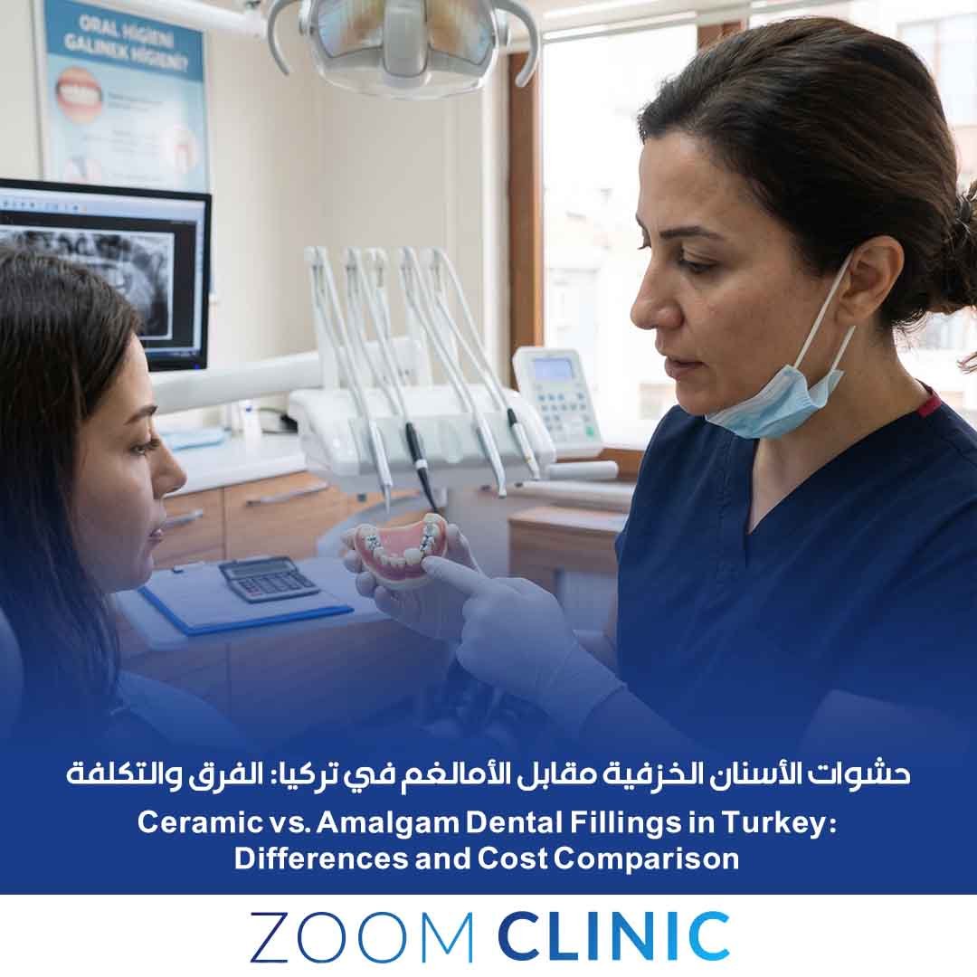 حشوات الأسنان الخزفية