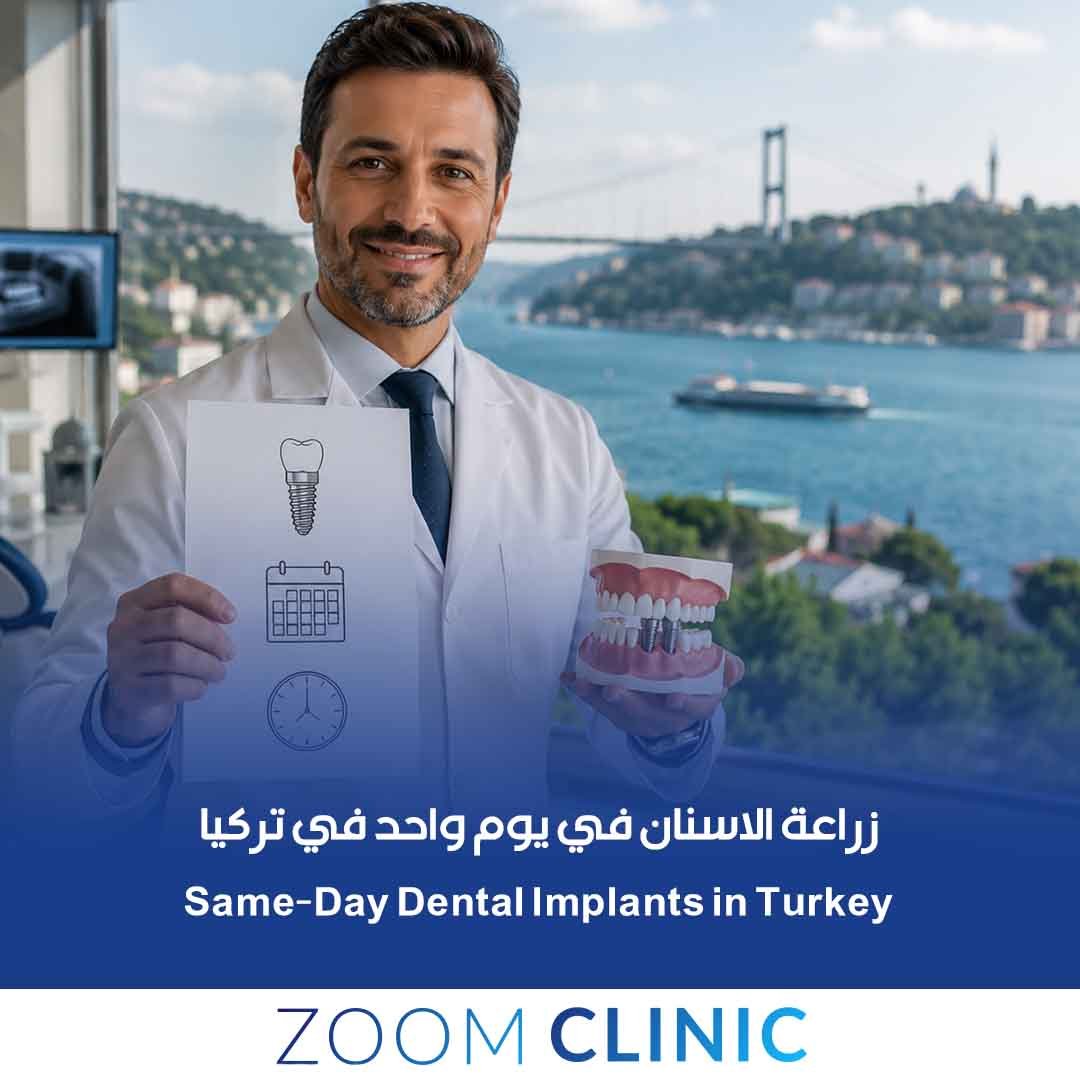 زراعة الاسنان في يوم واحد