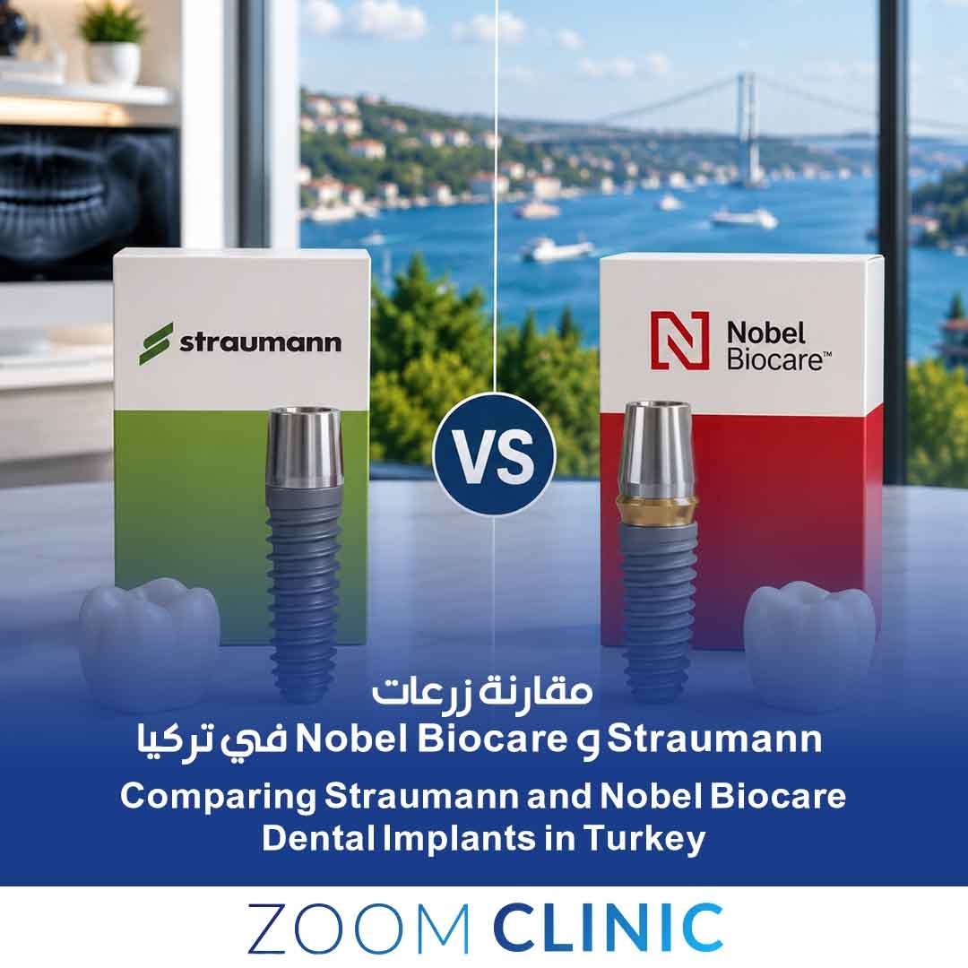 مقارنة زرعات Straumann و Nobel Biocare