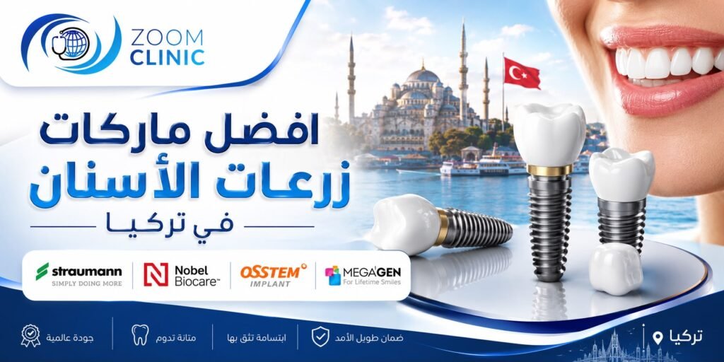 أفضل ماركات زرعات الأسنان