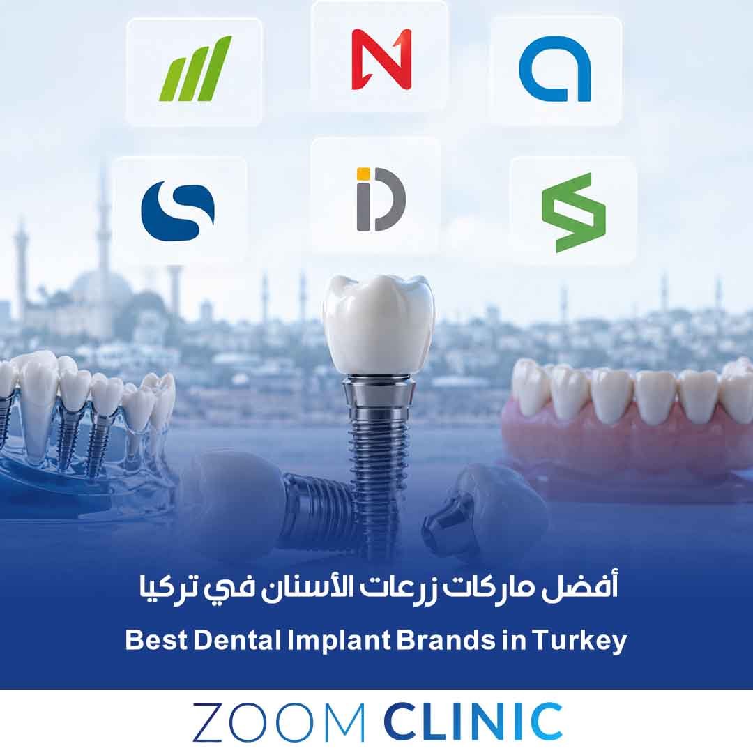 Dental Implant Brands