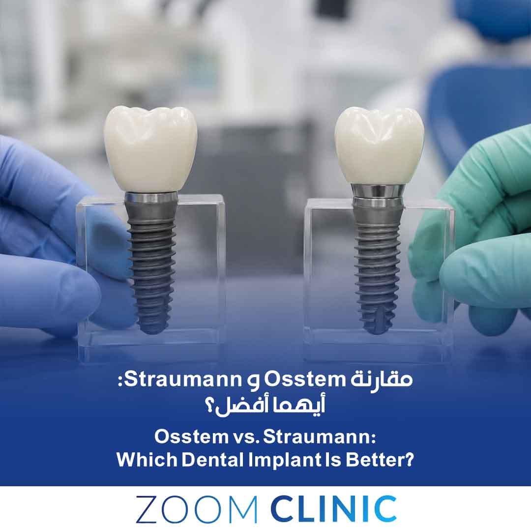 مقارنة Osstem و Straumann