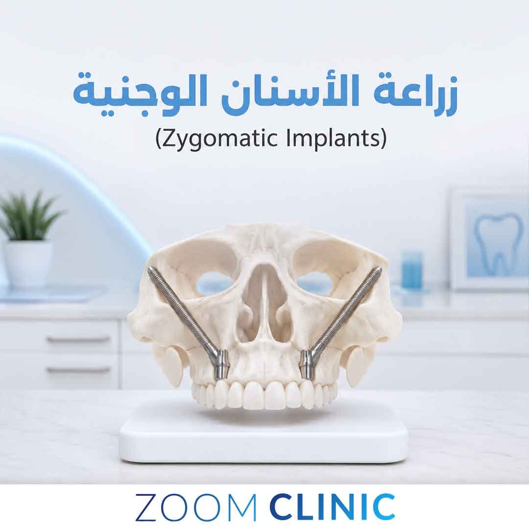 زراعة الاسنان الوجينية