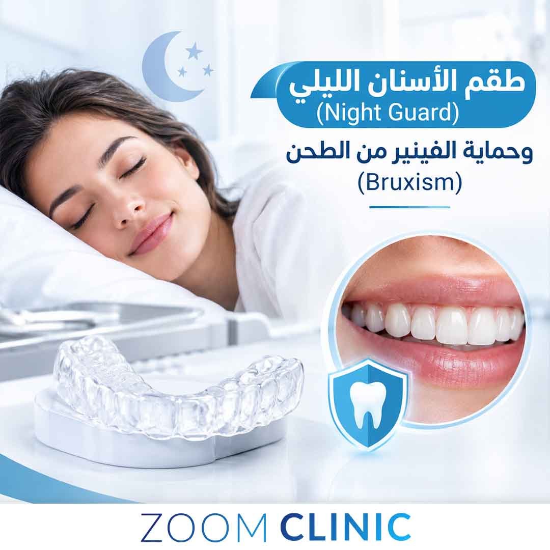 Night Guard for Protecting Veneers